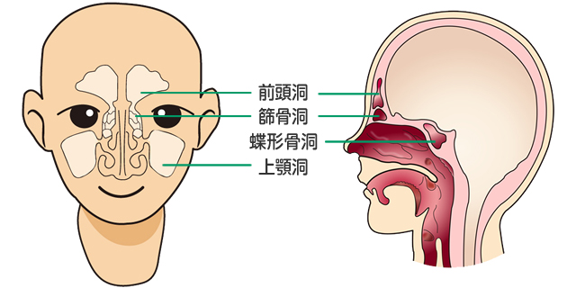 副鼻腔炎